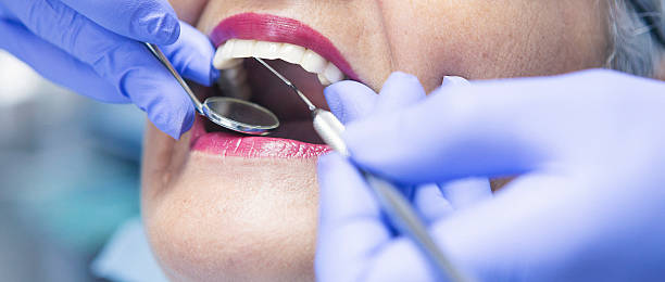 Best Emergency Gum Treatment in Exton, PA